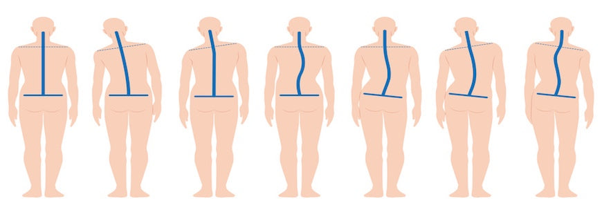 seven drawings of human beings with different shapes spines highlighted in blue